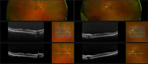 How Optical Expressions Can Assist